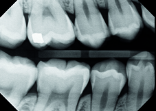 Midmark/Progeny Preva DC Intraoral X-Ray ***NEW - HUBdental.com